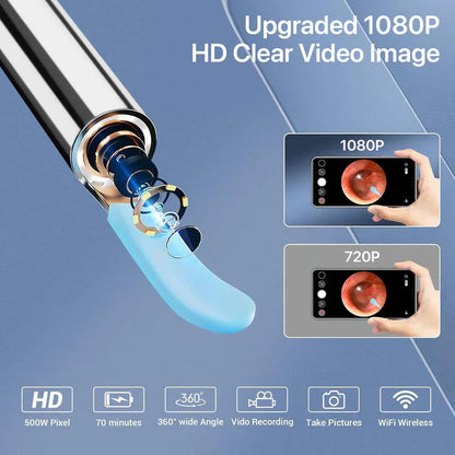 Smart Visual Ear Wax Cleaner With Camera